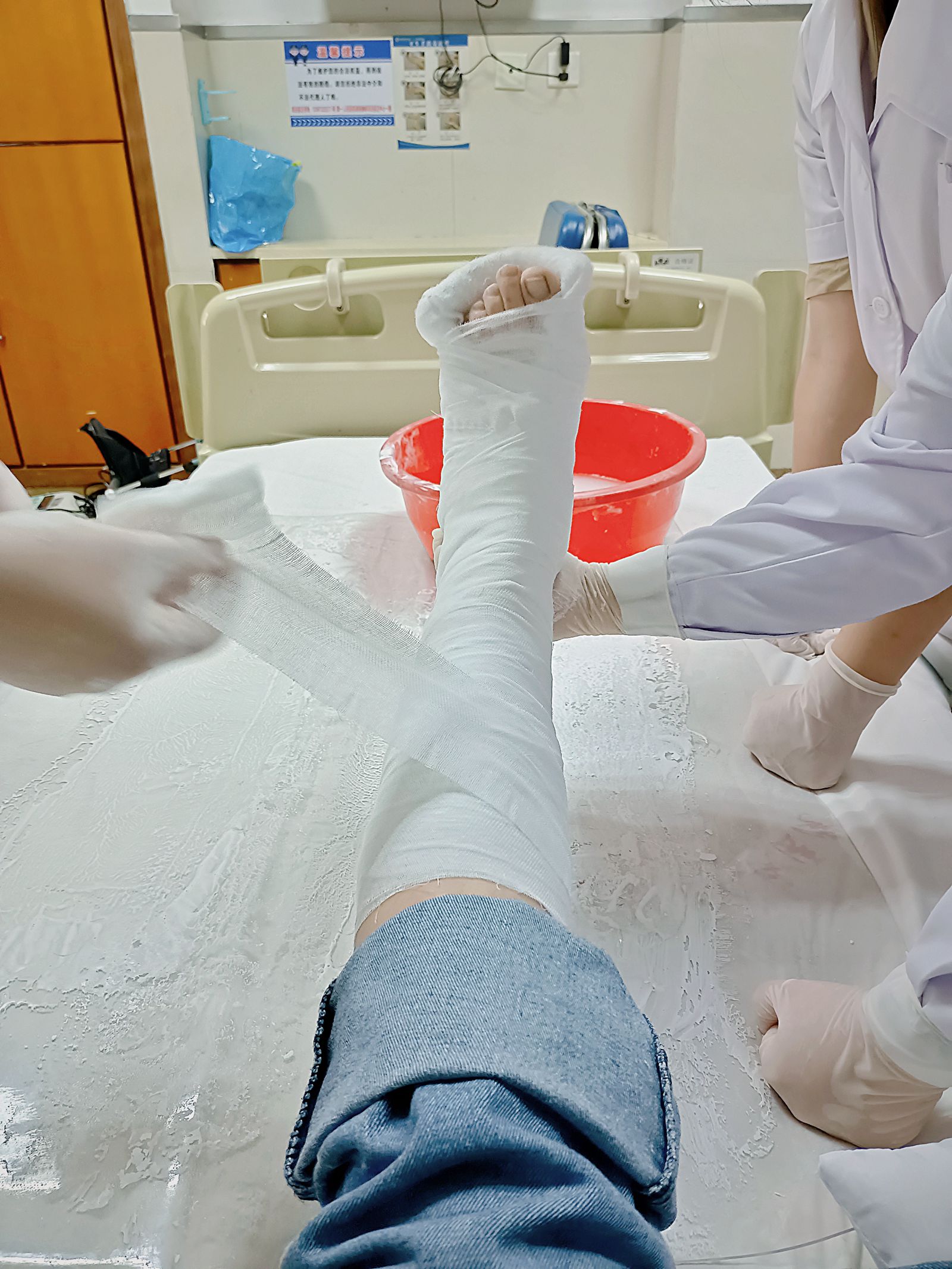 骨科护士带你全程体验,打石膏原来是这样的操作 学术资讯 - 科创中国