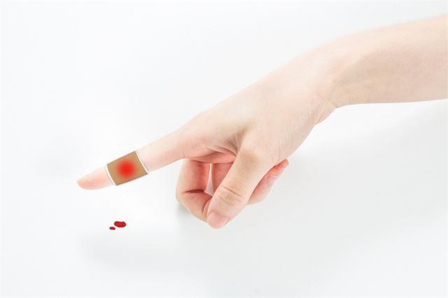 青岛大学首创干细胞“创可贴”：创口无需植皮缝合，贴上就能快速复原